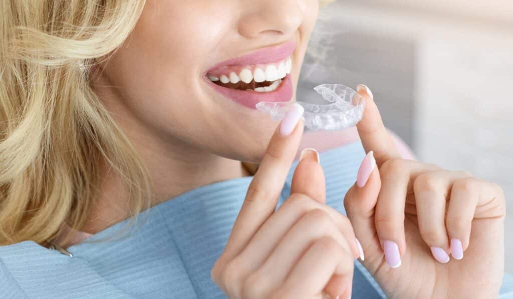 Banner,For,Invisalign,Orthodontics,,Modern,Dentistry,Concept.,Unrecognizable,Blonde,Woman